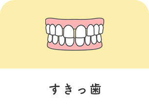 すきっ歯